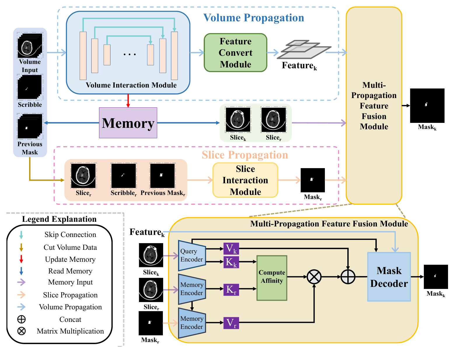 ICH-HPINet: a hybrid propagation interaction network for intelligent and interactive 3D intracerebral hemorrhage segmentation